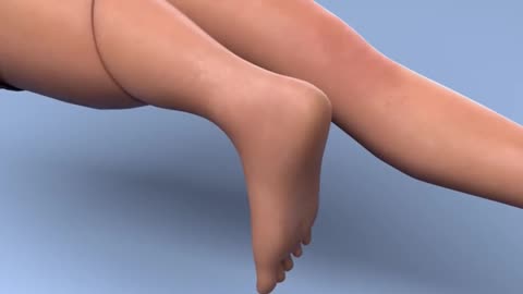 Rotationplasty Procedure 3D Animation