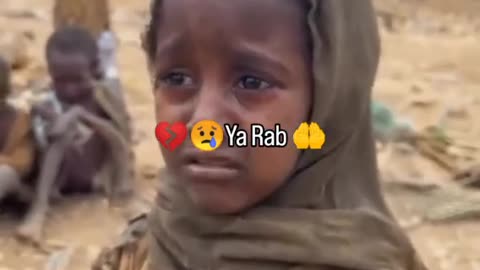 Children’s Faces Destroyed by the Fake Royals of the UAE — Supporting Terror in Sudan!