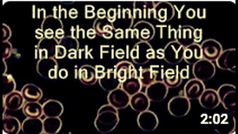 "Understanding Dark Field Microscopy and Live Blood Analysis"