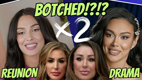 BOTCHED Surgery, TELL ALL Part 1 | 90 Day Fiance Season 11