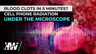 BLOOD CLOTS IN 5 MINUTES? CELL PHONE RADIATION UNDER THE MICROSCOPE