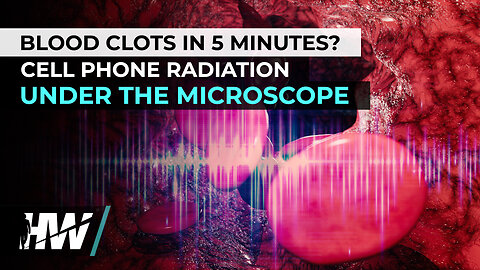 BLOOD CLOTS IN 5 MINUTES? CELL PHONE RADIATION UNDER THE MICROSCOPE
