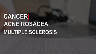 PARASITES - THE CANCER WITHIN here is your proof that parasites are the cause of cancer