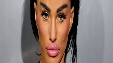 Katie Price Shows Off New Classy Lips and Plumpe