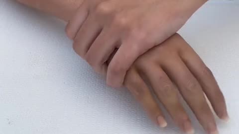 Artificial Body Parts - Silicone Prosthesis