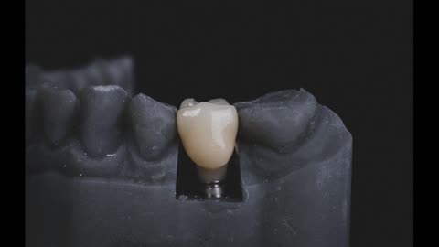 Cusp Dental Design