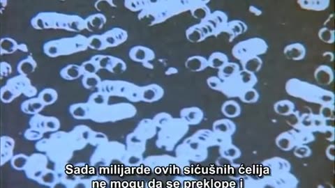 The Gerson Miracle 2004 ‧ Documentary ‧ ( cancer ♋)