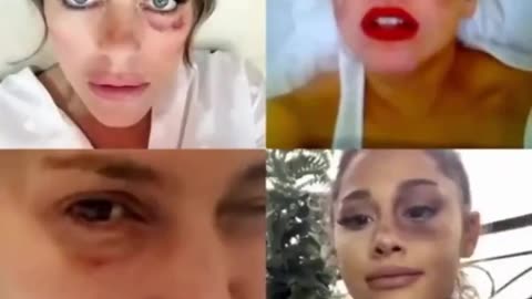 Do you know what the Black Eye Club is? THE WHITE RABBIT 👁