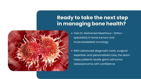 Giant Cell Tumor| Treatment for Giant Cell Tumors| Osteosarcoma Treatment