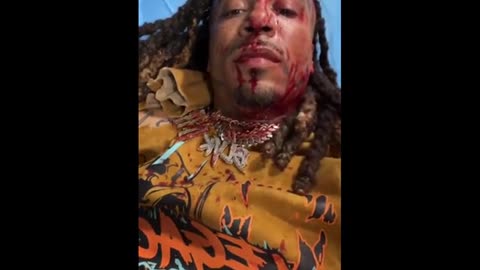 Dallas Rapper 'Bedorichasz' Getting Shot