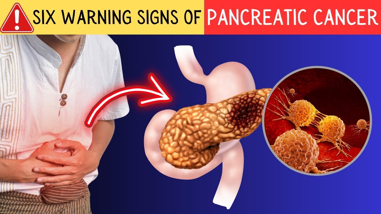 Catch These Six Subtle Signals of Pancreatic Cancer Before It’s Too Late! MD02
