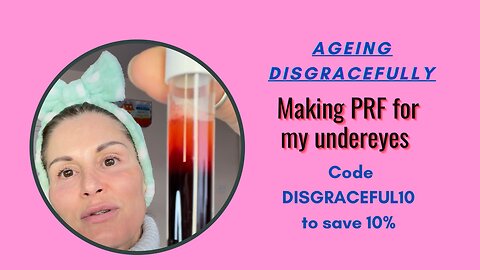 Making PRF for my undereyes