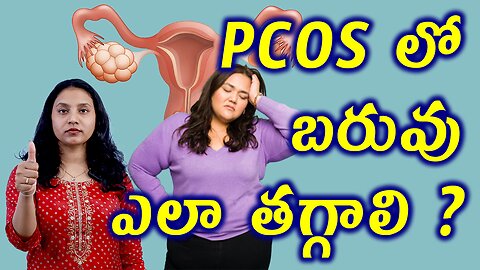 PCOS లో బరువు ఎలా తగ్గాలి? How to Loose Weight in PCOS? Best Homeopathy Treatment Medicine Cure Tips