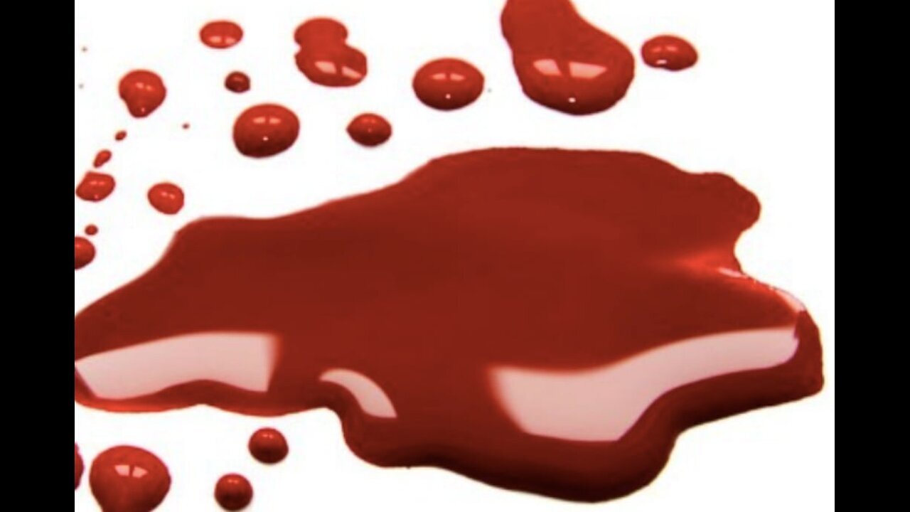 Americans Must STOP The Bleeding! The Country's Life Depends Upon Them