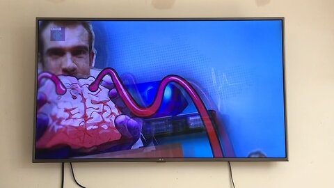 Operation Ouch Intro 2022