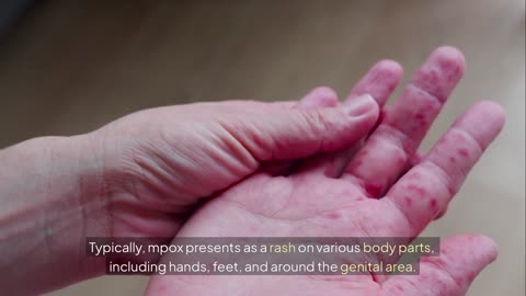 Health officials in Los Angeles County