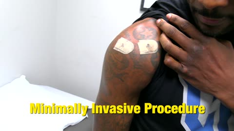 🥊 Cannonhandz Repaired! Dr. Barbour Restores Power with a Knockout Rotator Cuff Fix 💥🛠️