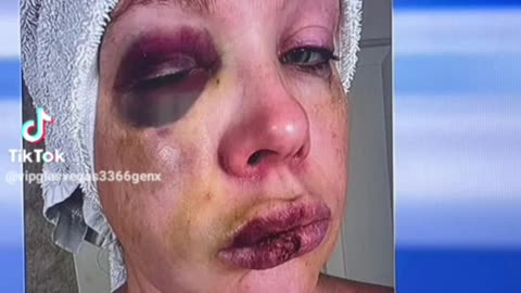 Ohio Senator releases shocking image of Cincinnati victim