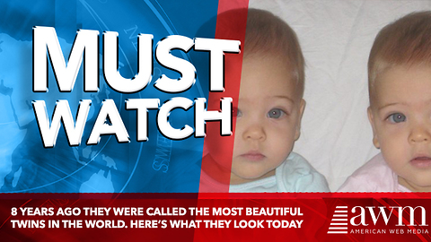 8 Years Ago They Were Called The Most Beautiful Twins In The World. Here’s What They Look Today