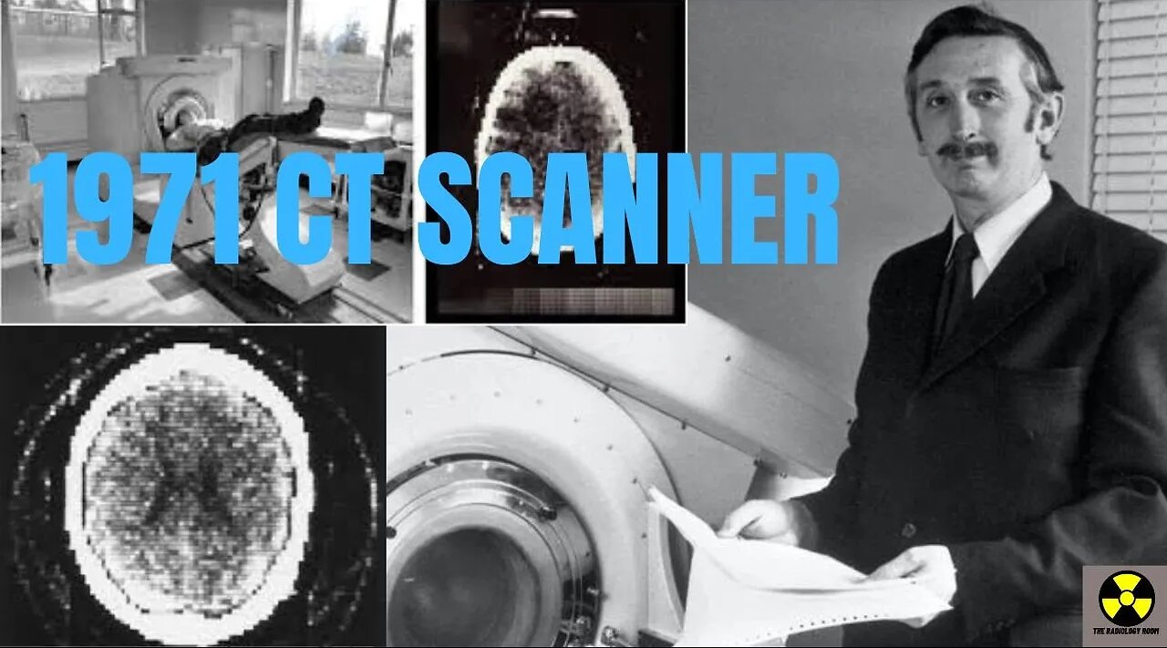 The 1971 CT Scanner