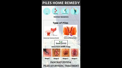 Bawasir से छुटकारा पाने के लिए 10 रामबाड़ घरेलु उपचार | Piles Home Remedy #shortsvideo #बवासीर_Tips