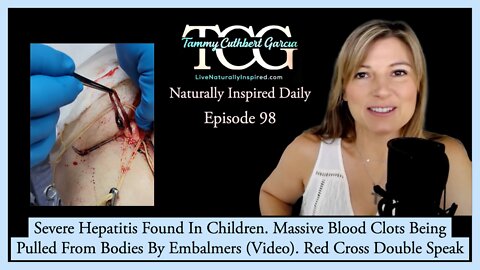 Severe Hepatitis Found In Children. Massive Blood Clots Being Pulled From Bodies By Embalmers.