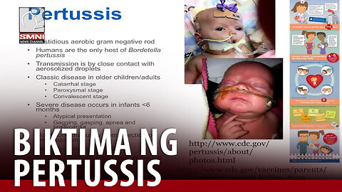 Mga nasawi dahil sa pertussis, puro bata −DOH
