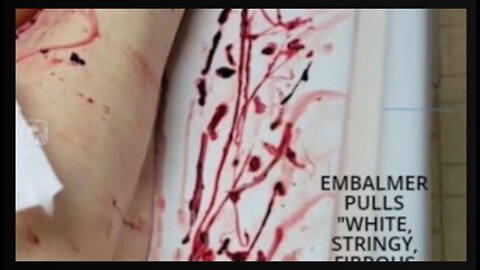 Got Covid Vaccine Injuries_ Here's A Message From Your Government!!!
