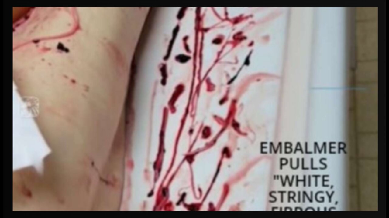 Got Covid Vaccine Injuries_ Here's A Message From Your Government!!!