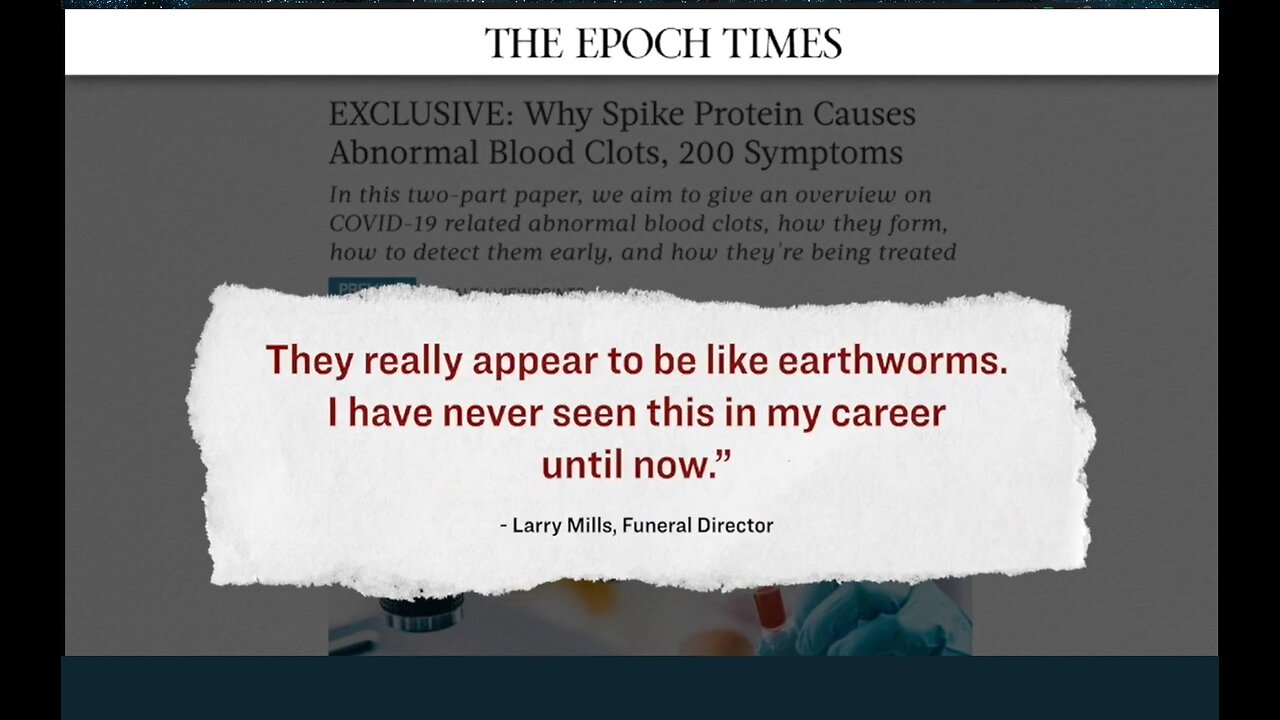 Epoch Times | Lengthy #Clots Found in Jab Recipients