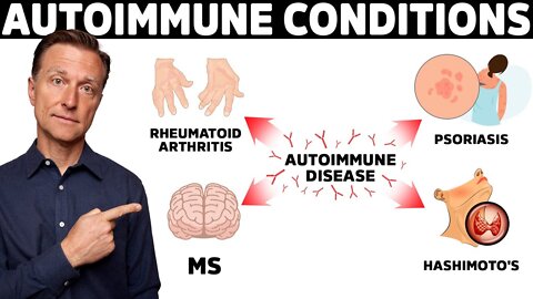 7 Surprising Causes of Autoimmune Diseases They Never Told You About