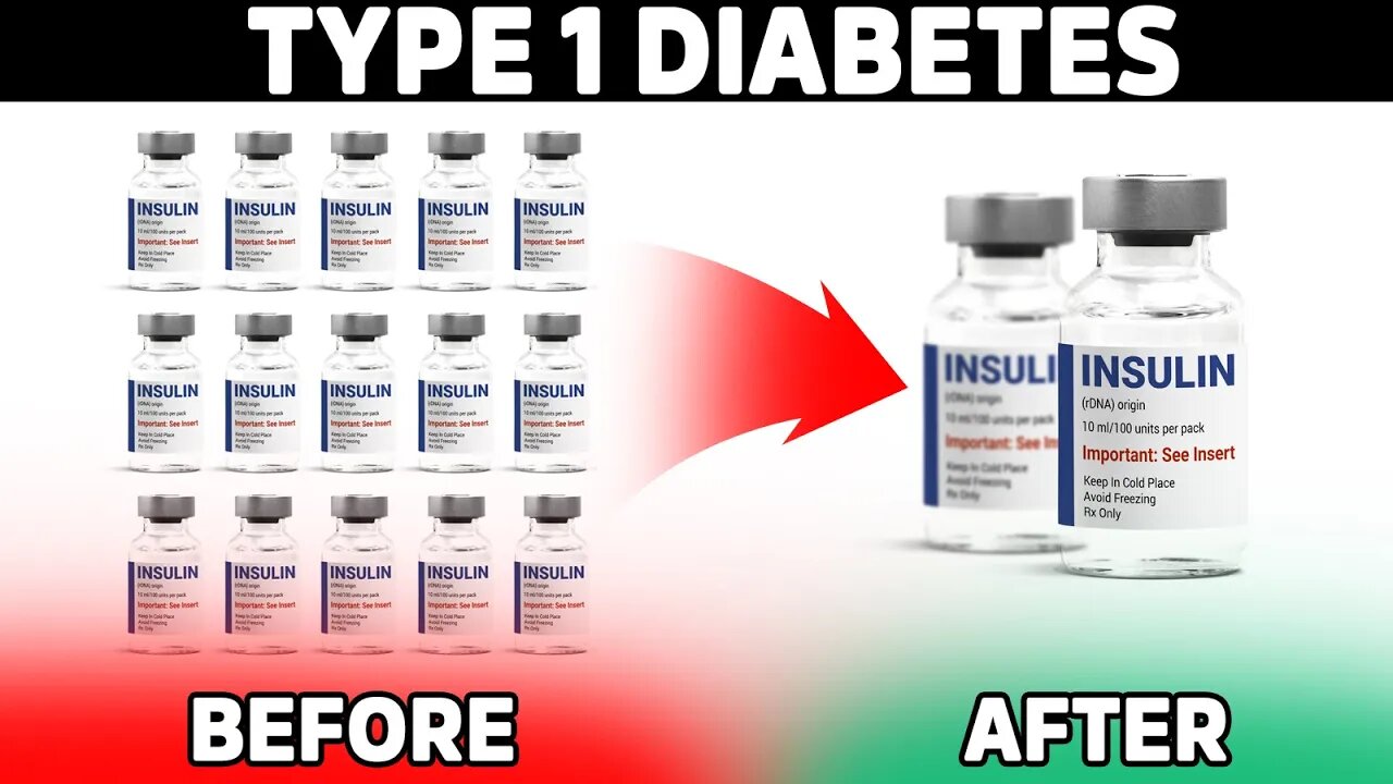 Type 1 Diabetics MUST Do This to Reduce Insulin