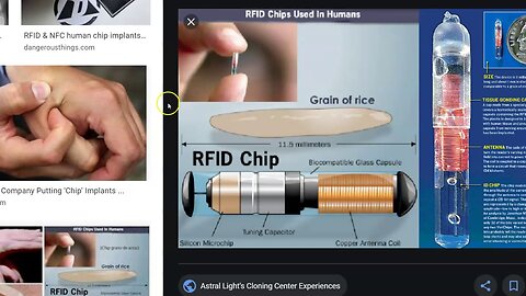 Banking Insider Warns CBDC's Will Be 'Implanted C-HIP'