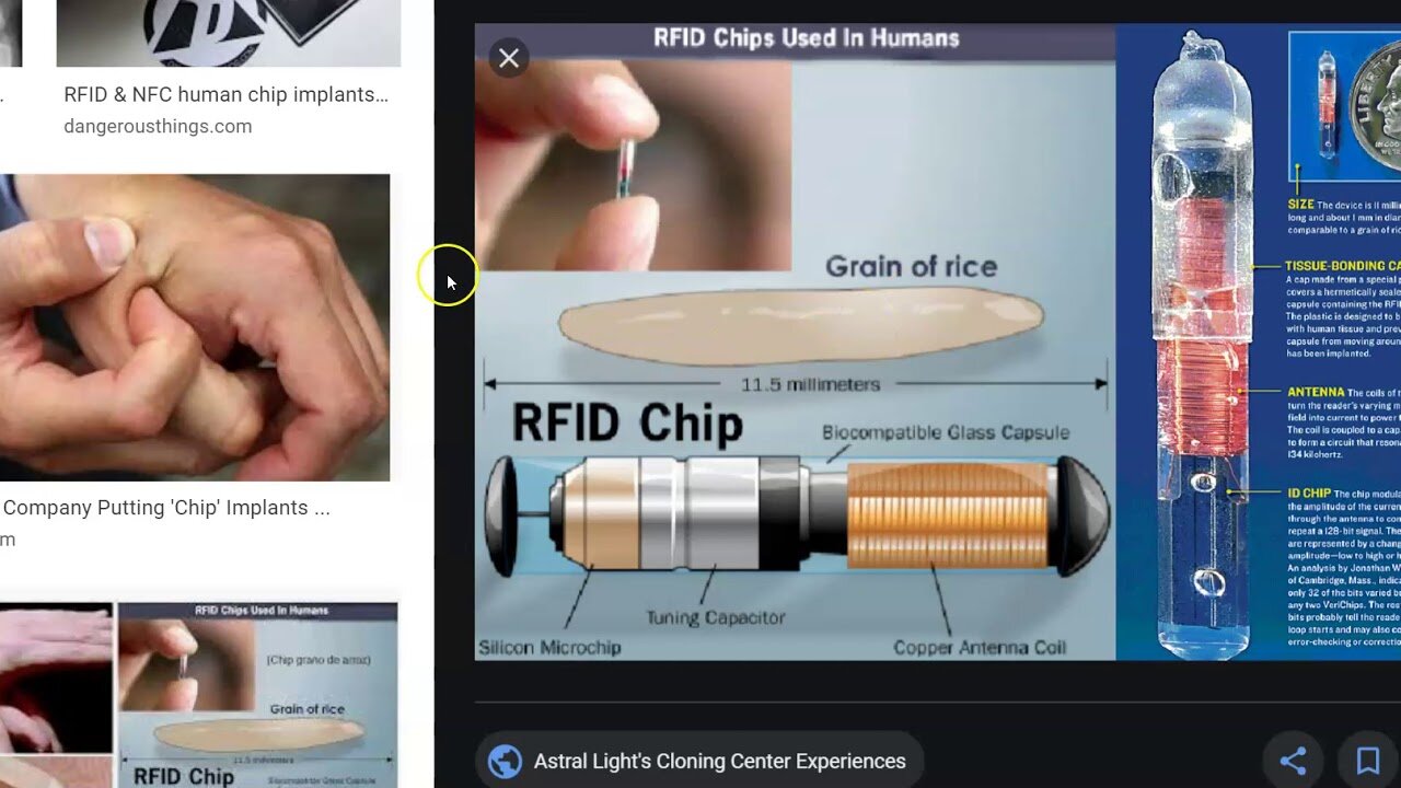 Banking Insider Warns CBDC's Will Be 'Implanted C-HIP'