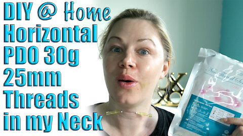 DIY @ Home Horizontal PDO (30g25mm) Threads in my Neck fm www.glamderma.com | Code Jessica10 Saves $