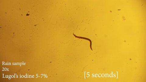 2022-06-30 Moving organisms on Lugols Iodine (Interchema)