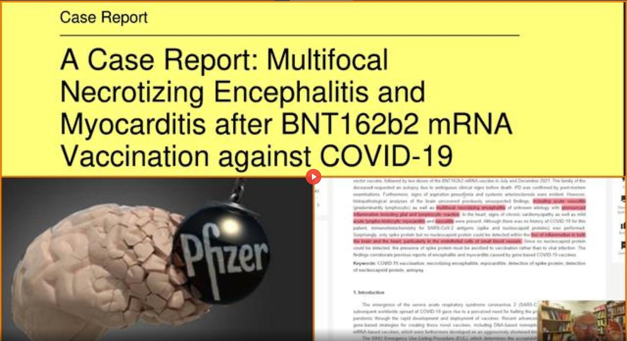 JEREMY POOLE: PROOF. BRAIN DAMAGE CAUSED BY 'VACCINE'!!!!! GERMAN STUDY!!