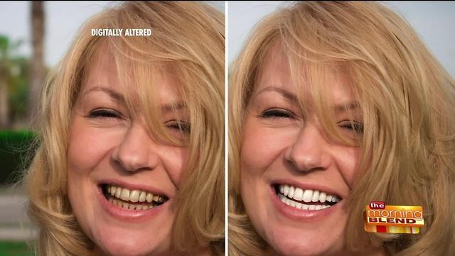 Whiter Teeth in Just 5 Minutes a Day