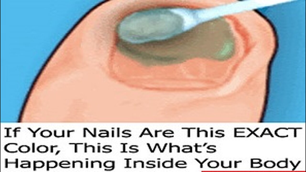 If Your Nails Are This EXACT Color, This Is What's Happening Inside Your Body (Do This Now)