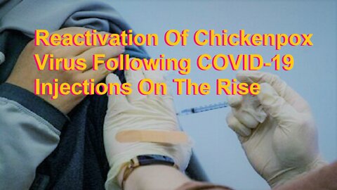 Reactivation Of Chickenpox Virus Following COVID-19 Injections On The Rise