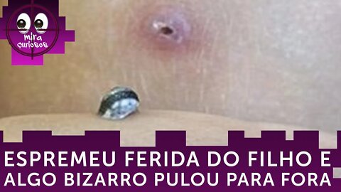 Mãe espreme ferida no joelho do filho e algo bizarro vivendo dentro dele pula para fora
