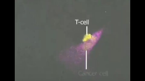 Watch how a T cell kills a cancer cell. Our natural immune system is incredible!