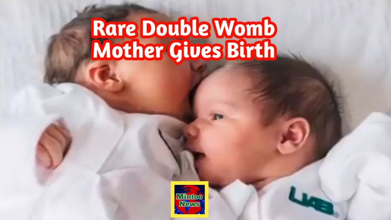 US woman with rare double womb has two babies in two days