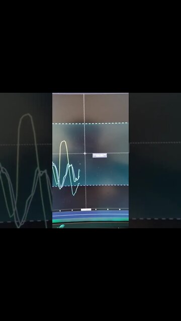 Bitcoin Bear Trap Potential Situation & Targets. #Shorts