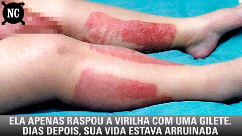 Ela apenas raspou a virilha com uma gilete. Dias depois, sua vida estava arruinada