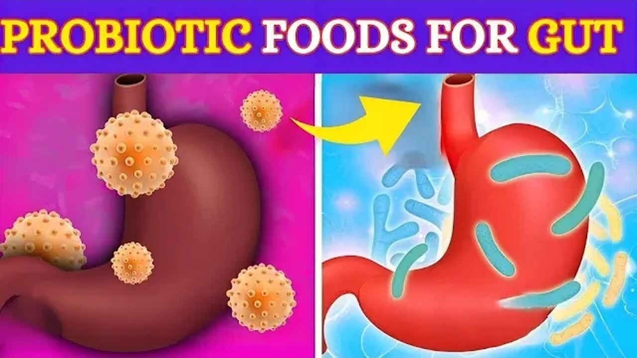 Top 6 Best Prebiotic Foods That Improve Gut Health in 2023