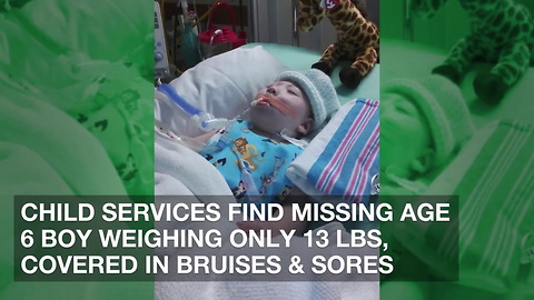 Child Services Find Missing Age 6 Boy Weighing Only 13 Lbs, Covered in Bruises & Sores