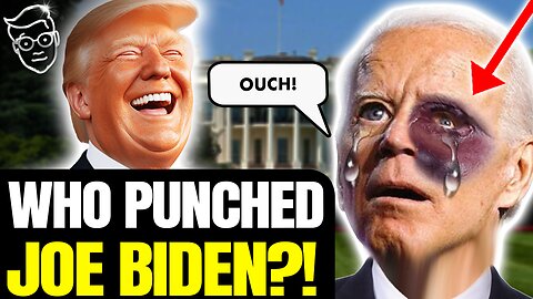 Biden Appears in Public With MASSIVE Mysterious BLACK Bruise On FACE! Elder Abuse? Another Collapse?