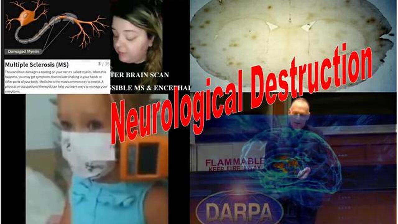 NEUROLOGICAL DESTRUCTION - The Brain as the Battlefield