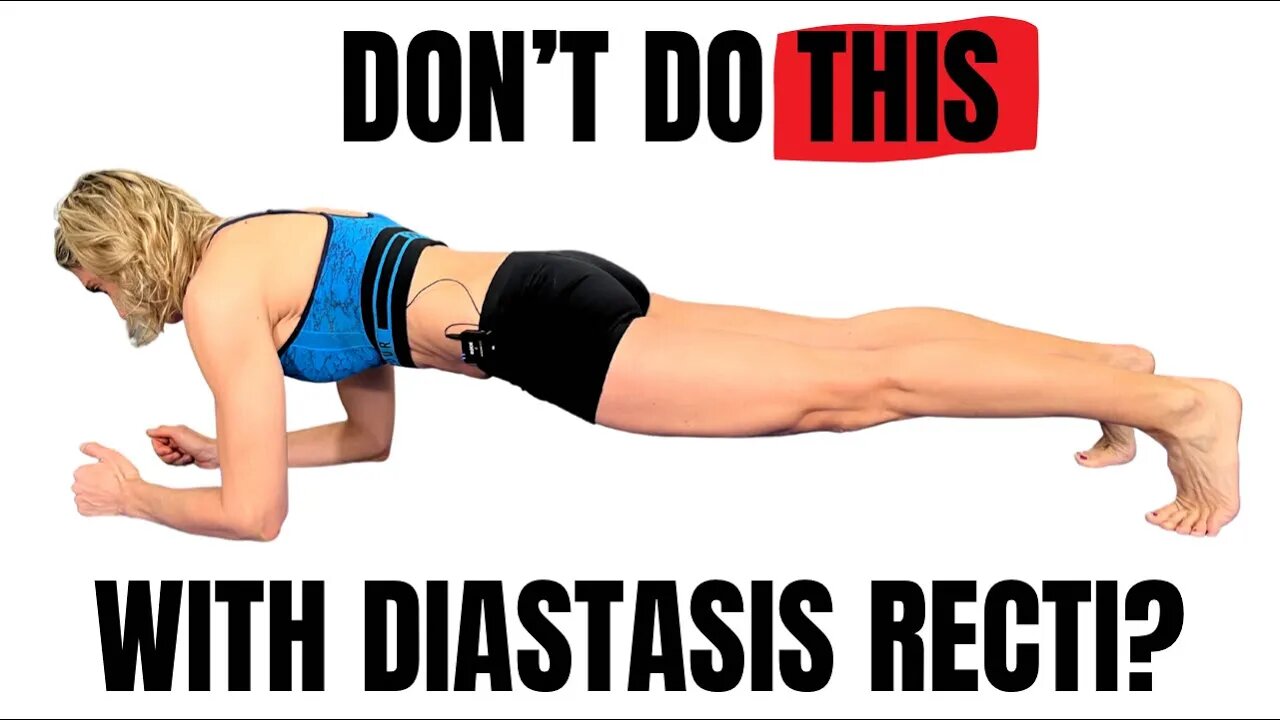 Diastasis Recti